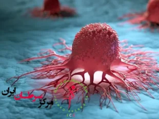 کمک هوش مصنوعی برای پیش‌بینی سرطان